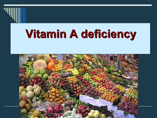 Vitamin a-deficiency | PPT