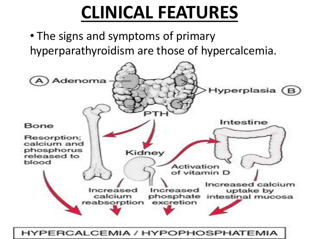 VITAMIN D AND HYPERPARATHYROIDISM