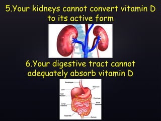 5.Your kidneys cannot convert vitamin D
to its active form
6.Your digestive tract cannot
adequately absorb vitamin D
 