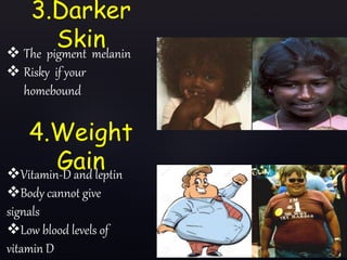 3.Darker
Skin The pigment melanin
 Risky if your
homebound
4.Weight
GainVitamin-D and leptin
Body cannot give
signals
Low blood levels of
vitamin D
 