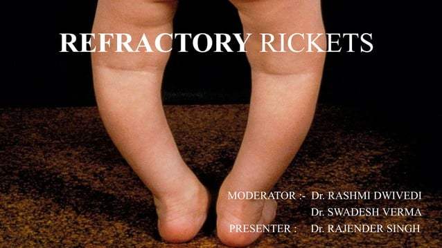 VITAMIN-D RESISTANT RICKETS.ppt educationx | PPTX | Endocrine and ...