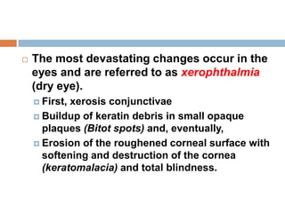  The most devastating changes occur in the
eyes and are referred to as xerophthalmia
(dry eye).
 First, xerosis conjunctivae
 Buildup of keratin debris in small opaque
plaques (Bitot spots) and, eventually,
 Erosion of the roughened corneal surface with
softening and destruction of the cornea
(keratomalacia) and total blindness.
 