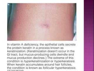 © 2008 Thomson - Wadsworth
 