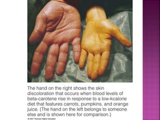 © 2008 Thomson - Wadsworth
 