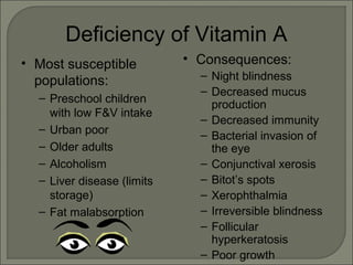 Deficiency of Vitamin A
• Most susceptible
populations:
– Preschool children
with low F&V intake
– Urban poor
– Older adults
– Alcoholism
– Liver disease (limits
storage)
– Fat malabsorption
• Consequences:
– Night blindness
– Decreased mucus
production
– Decreased immunity
– Bacterial invasion of
the eye
– Conjunctival xerosis
– Bitot’s spots
– Xerophthalmia
– Irreversible blindness
– Follicular
hyperkeratosis
– Poor growth
 