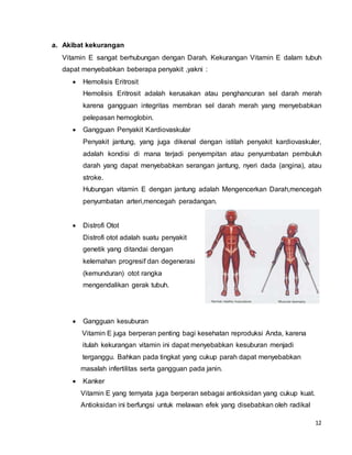 12
a. Akibat kekurangan
Vitamin E sangat berhubungan dengan Darah. Kekurangan Vitamin E dalam tubuh
dapat menyebabkan beberapa penyakit ,yakni :
 Hemolisis Eritrosit
Hemolisis Eritrosit adalah kerusakan atau penghancuran sel darah merah
karena gangguan integritas membran sel darah merah yang menyebabkan
pelepasan hemoglobin.
 Gangguan Penyakit Kardiovaskular
Penyakit jantung, yang juga dikenal dengan istilah penyakit kardiovaskuler,
adalah kondisi di mana terjadi penyempitan atau penyumbatan pembuluh
darah yang dapat menyebabkan serangan jantung, nyeri dada (angina), atau
stroke.
Hubungan vitamin E dengan jantung adalah Mengencerkan Darah,mencegah
penyumbatan arteri,mencegah peradangan.
 Distrofi Otot
Distrofi otot adalah suatu penyakit
genetik yang ditandai dengan
kelemahan progresif dan degenerasi
(kemunduran) otot rangka
mengendalikan gerak tubuh.
 Gangguan kesuburan
Vitamin E juga berperan penting bagi kesehatan reproduksi Anda, karena
itulah kekurangan vitamin ini dapat menyebabkan kesuburan menjadi
terganggu. Bahkan pada tingkat yang cukup parah dapat menyebabkan
masalah infertilitas serta gangguan pada janin.
 Kanker
Vitamin E yang ternyata juga berperan sebagai antioksidan yang cukup kuat.
Antioksidan ini berfungsi untuk melawan efek yang disebabkan oleh radikal
 