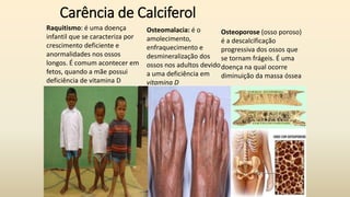 Carência de Calciferol
Osteomalacia: é o
amolecimento,
enfraquecimento e
desmineralização dos
ossos nos adultos devido
a uma deficiência em
vitamina D
Raquitismo: é uma doença
infantil que se caracteriza por
crescimento deficiente e
anormalidades nos ossos
longos. É comum acontecer em
fetos, quando a mãe possui
deficiência de vitamina D
Osteoporose (osso poroso)
é a descalcificação
progressiva dos ossos que
se tornam frágeis. É uma
doença na qual ocorre
diminuição da massa óssea
 