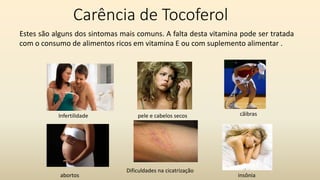 Carência de Tocoferol
Infertilidade
Estes são alguns dos sintomas mais comuns. A falta desta vitamina pode ser tratada
com o consumo de alimentos ricos em vitamina E ou com suplemento alimentar .
abortos
pele e cabelos secos cãibras
Dificuldades na cicatrização
insônia
 