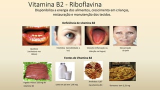 Vitamina B2 - Riboflavina
Deficiência de vitamina B2
Queilose
(rachadura nos
lábios)
Fotofobia (Sensibilidade a
luz)
Descamação
da pele
Glossite (inflamação ou
infecção na língua)
Fontes de Vitamina B2
Fígado: Possui 3,01mg de
vitamina B2
Disponibiliza a energia dos alimentos, crescimento em crianças,
restauração e manutenção dos tecidos.
Leite em pó tem 1,46 mg Torresmo: tem 2,25 mg
Amêndoa: 0,67
mg vitamina B1
 
