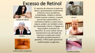 Excesso de Retinol
O excesso de vitamina A pode ser
tóxico, apresentando inicialmente
sintomas como sonolência,
irritabilidade, cefaléia e vômito.
Cabelo escasso e áspero, a queda
parcial das sobrancelhas, as
rachaduras labiais e a pele seca e
áspera, podem ser também sinais
de intoxicação crônica. O fígado e o
baço podem aumentar de
tamanho. Se uma mulher tomar
isotretinoína (um derivado da
vitamina A usado para tratar
afecções da pele) durante a
gravidez, o filho pode apresentar
malformações congênitas.
sonolência
malformações congênitas.
cefaléia
Queda de cabelo
rachaduras labiais
vômito
 