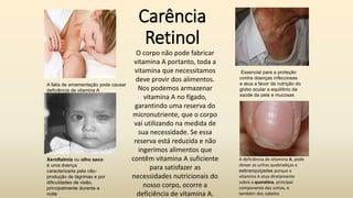 Carência
Retinol
Xeroftalmia ou olho seco
é uma doença
caracterizada pela não-
produção de lágrimas e por
dificuldades de ...