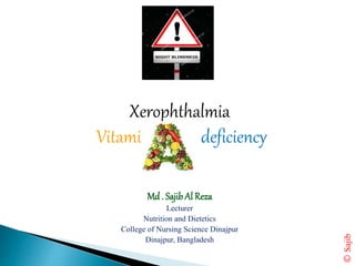 Xerophthalmia
Vitamin - deficiency
Md . SajibAl Reza
Lecturer
Nutrition and Dietetics
College of Nursing Science Dinajpur
Dinajpur, Bangladesh
©Sajib
 