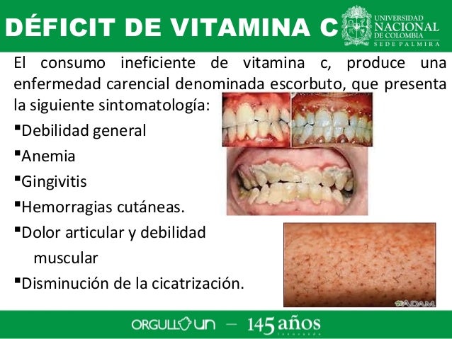 Vitamina c bioquimica