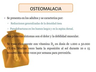 OSTEOMALACIA
 