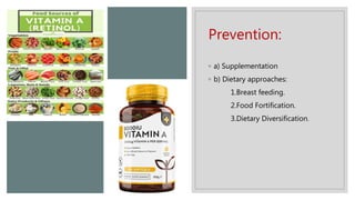 Vitamin a deficiency | PPTX