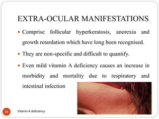 EXTRA-OCULAR MANIFESTATIONS
11/14/2021
Vitamin A deficiency
20
 Comprise follicular hyperkeratosis, anorexia and
growth retardation which have long been recognised.
 They are non-specific and difficult to quantify.
 Even mild vitamin A deficiency causes an increase in
morbidity and mortality due to respiratory and
intestinal infection
 