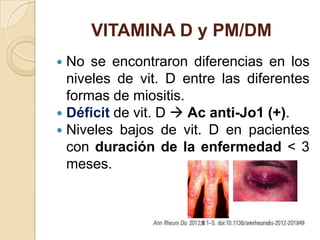VITAMINA D y PM/DM
 No se encontraron diferencias en los
  niveles de vit. D entre las diferentes
  formas de miositis.
 Déficit de vit. D  Ac anti-Jo1 (+).
 Niveles bajos de vit. D en pacientes
  con duración de la enfermedad < 3
  meses.
 