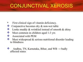 CONJUNCTIVAL XEROSIS
 First clinical sign of vitamin deficiency.
 Conjunctiva becomes dry & non-wet table
 Looks muddy & wrinkled instead of smooth & shiny
 Most common in children aged 1-3 yrs
 Associated with PEM
 Most widespread & serious nutritional disorder leading
to blindness
 Andhra, TN, Karnataka, Bihar, and WB → badly
affected states
 