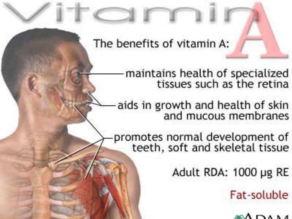 Vitamin a presentation, Vitamin A Deficiency, Vitamin A toxicity