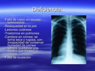Deficiencia: -Falla de visión en escasa luminosidad -Resequedad en la piel -Lesiones cutáneas -Trastornos en pulmones -Cambios en cornea; se torna seca y rugosa, con incapacidad de conservar humedad (la cornea sanara quedando una cicatriz que limitara la visión)  -Falta de ovulación  