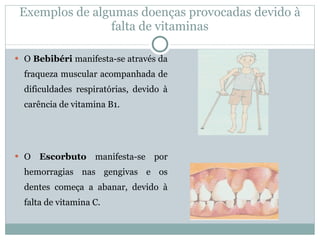 O  Bebibéri  manifesta-se através da fraqueza muscular acompanhada de dificuldades respiratórias, devido à carência de vitamina B1. O  Escorbuto  manifesta-se por hemorragias nas gengivas e os dentes começa a abanar, devido à falta de vitamina C. Exemplos de algumas doenças provocadas devido à falta de vitaminas 
