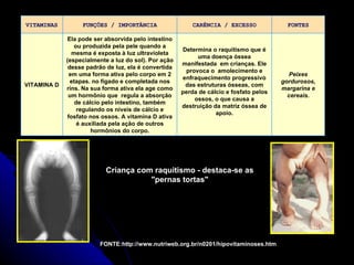 Criança com raquitismo - destaca-se as "pernas tortas" FONTE:http://www.nutriweb.org.br/n0201/hipovitaminoses.htm VITAMINAS FUNÇÕES / IMPORTÂNCIA CARÊNCIA / EXCESSO FONTES VITAMINA D Ela pode ser absorvida pelo intestino ou produzida pela pele quando a mesma é exposta à luz ultravioleta (especialmente a luz do sol). Por ação desse padrão de luz, ela é convertida em uma forma ativa pelo corpo em 2 etapas. no fígado e completada nos rins. Na sua forma ativa ela age como um hormônio que  regula a absorção de cálcio pelo intestino, também regulando os níveis de cálcio e fosfato nos ossos. A vitamina D ativa é auxiliada pela ação de outros hormônios do corpo. Determina o raquitismo que é uma doença óssea manifestada  em crianças. Ele provoca o  amolecimento e enfraquecimento progressivo das estruturas ósseas, com perda de cálcio e fosfato pelos ossos, o que causa a destruição da matriz óssea de apoio. Peixes gordurosos, margarina e cereais. 