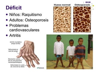 Déficit Niños: Raquitismo Adultos: Osteoporosis Problemas cardiovasculares Artritis 