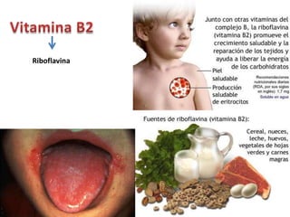 Riboflavina
 