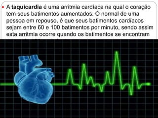  A taquicardia é uma arritmia cardíaca na qual o coração
tem seus batimentos aumentados. O normal de uma
pessoa em repouso, é que seus batimentos cardíacos
sejam entre 60 e 100 batimentos por minuto, sendo assim
esta arritmia ocorre quando os batimentos se encontram
acima de 100 por minuto.
 