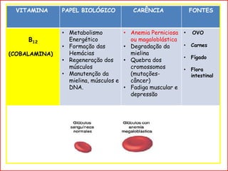 Anemia perniciosa
VITAMINA PAPEL BIOLÓGICO CARÊNCIA FONTES
B12
(COBALAMINA)
• Metabolismo
Energético
• Formação das
Hemácias
• Regeneração dos
músculos
• Manutenção da
mielina, músculos e
DNA.
• Anemia Perniciosa
ou magaloblástica
• Degradação da
mielina
• Quebra dos
cromossomos
(mutações-
câncer)
• Fadiga muscular e
depressão
• OVO
• Carnes
• Fígado
• Flora
intestinal
 