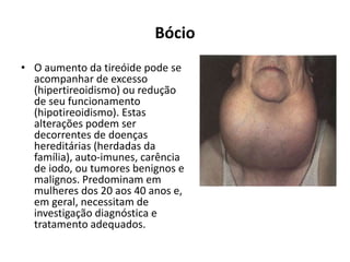 Bócio
• O aumento da tireóide pode se
acompanhar de excesso
(hipertireoidismo) ou redução
de seu funcionamento
(hipotireoidismo). Estas
alterações podem ser
decorrentes de doenças
hereditárias (herdadas da
família), auto-imunes, carência
de iodo, ou tumores benignos e
malignos. Predominam em
mulheres dos 20 aos 40 anos e,
em geral, necessitam de
investigação diagnóstica e
tratamento adequados.
 