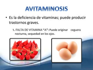 • Es la deficiencia de vitaminas; puede producir
trastornos graves.
1. FALTA DE VITAMINA “A”: Puede originar ceguera
nocturna, sequedad en los ojos.
 