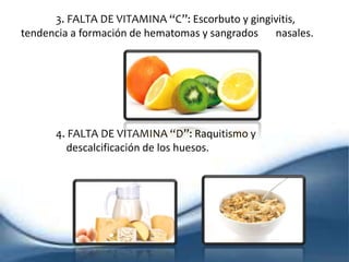 3. FALTA DE VITAMINA “C”: Escorbuto y gingivitis,
tendencia a formación de hematomas y sangrados nasales.
4. FALTA DE VITAMINA “D”: Raquitismo y
descalcificación de los huesos.
 