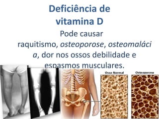 Papel bioquímico da vitamina B12Atua como co-fator de enzimas que catalisam rearranjos intramoleculares de ligações C-C, bem como metilações, está envolvida no catabolismo de vários aminoácidos, na oxidação de ácidos graxos e na formação da metionina pela metilação da homocisteína. homocisteínametionina