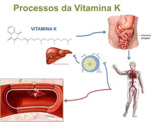 Excesso de vitamina DPode ocorrer um aumento da concentração de cálcio no sangue, calcificação de tecidos moles como rim, pulmões coração e até o tímpano do ouvido.
