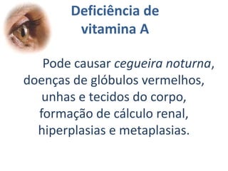 Apresentação das vitaminas:Vitamina A