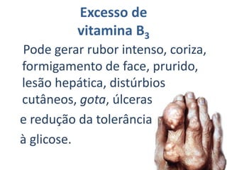 Vitamina B1TiaminaC12H17N4OS