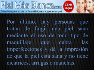 Por último, hay personas que
tratan de fingir una piel sana
mediante el uso de todo tipo de
maquillaje que cubra las
imperfecciones y dé la impresión
de que la piel está sana y no tiene
cicatrices, arrugas o manchas.
 