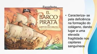 Escorbuto
• Caracteriza- se
pela deficiência
na formação do
colágeno, dando
lugar a uma
elevada
fragilidade nos
capilares
sanguíneos
 