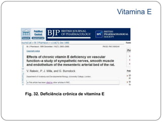 Vitamina E




Fig. 32. Deficiência crônica de vitamina E
 