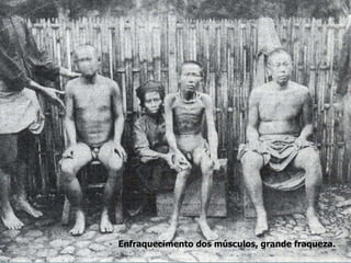 Enfraquecimento dos músculos, grande fraqueza. 