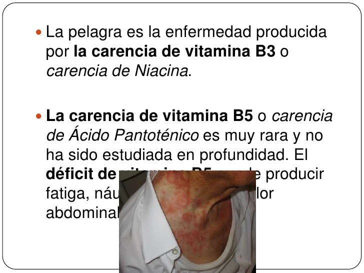 Los tipos de la eccema de la piel