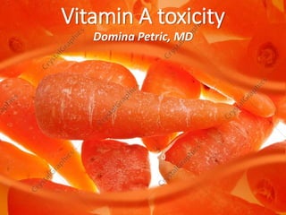 Domina Petric, MD
Vitamin A toxicity
 