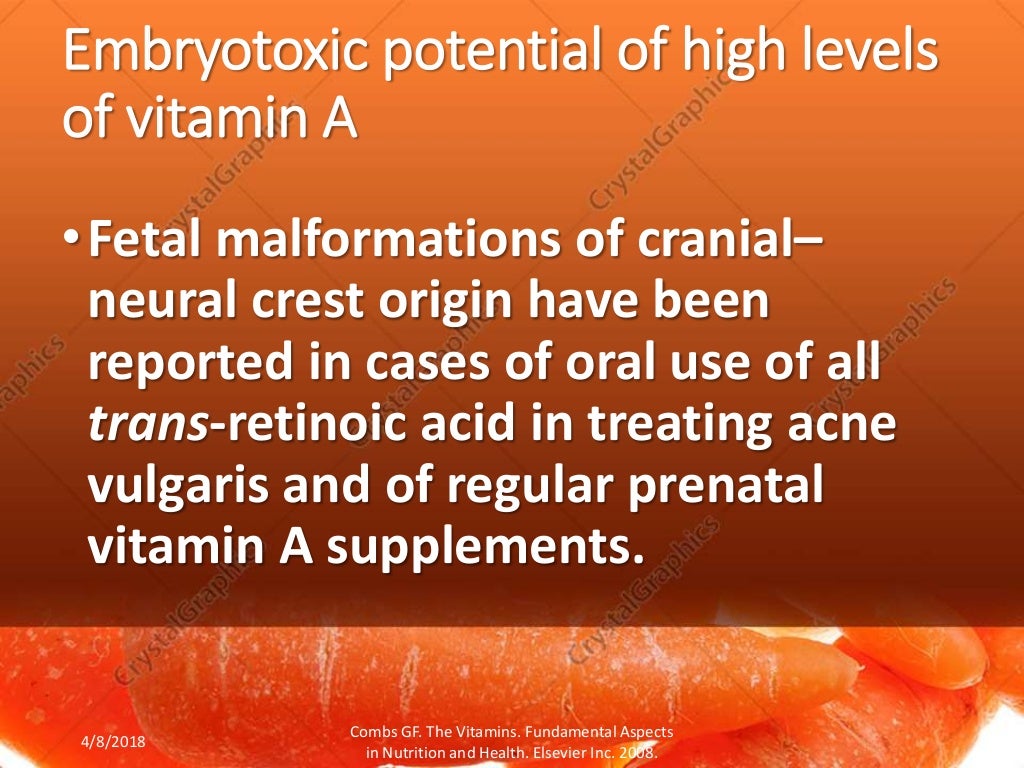 Vitamin A toxicity