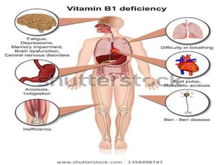 Vitamin b1