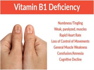 Vitamin b1