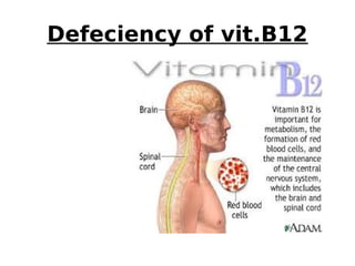 Defeciency of vit.B12
 