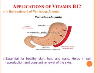 APPLICATIONS OF VITAMIN B12
 In the treatment of Pernicious Anemia:
 Essential for healthy skin, hair, and nails. Helps in cell
reproduction and constant renewal of the skin.
 
