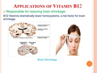 APPLICATIONS OF VITAMIN B12
 Responsible for reducing brain shrinkage:
B12 Vitamins dramatically lower homocysteine, a risk factor for brain
shrinkage.
Brain Shrinkage
 