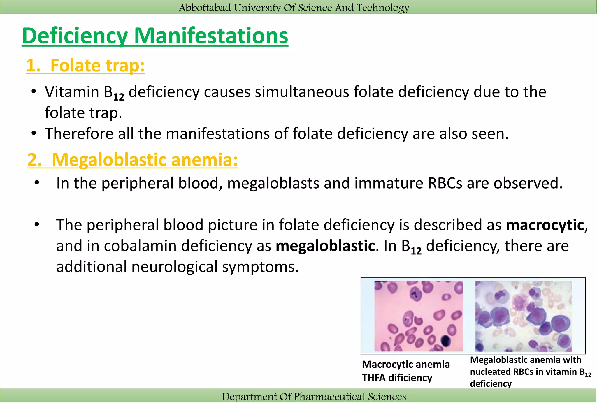 Abbottabad University Of Science And Technology
Department Of Pharmaceutical Sciences
Deficiency Manifestations
1. Folate trap:
• Vitamin B12 deficiency causes simultaneous folate deficiency due to the
folate trap.
• Therefore all the manifestations of folate deficiency are also seen.
2. Megaloblastic anemia:
• In the peripheral blood, megaloblasts and immature RBCs are observed.
• The peripheral blood picture in folate deficiency is described as macrocytic,
and in cobalamin deficiency as megaloblastic. In B12 deficiency, there are
additional neurological symptoms.
Macrocytic anemia
THFA dificiency
Megaloblastic anemia with
nucleated RBCs in vitamin B12
deficiency
 
